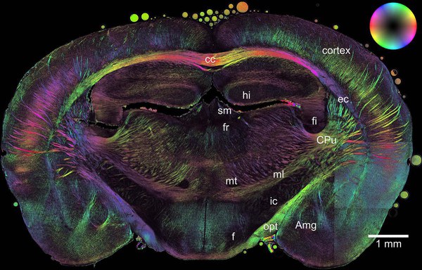 The brain is the centre of our nervous system – structural changes are often involved in neurological diseases and mental disorders. A method developed by neutron researchers at Jülich can be used to examine brain sections in order to better understand such diseases. Copyright: — Axer, Amunts et al. / INM-1, Forschungszentrum Jülich
